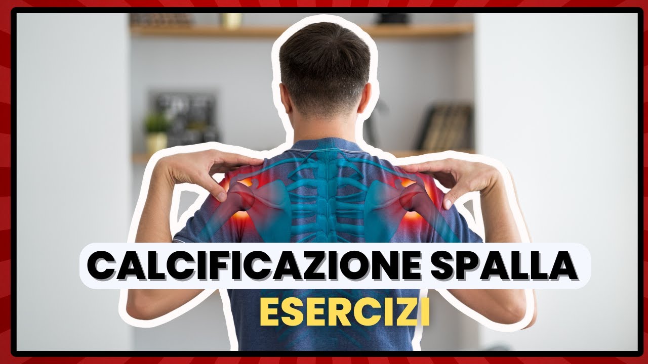 Come capire se il tuo DOLORE alla spalla deriva da una CALCIFICAZIONE ...