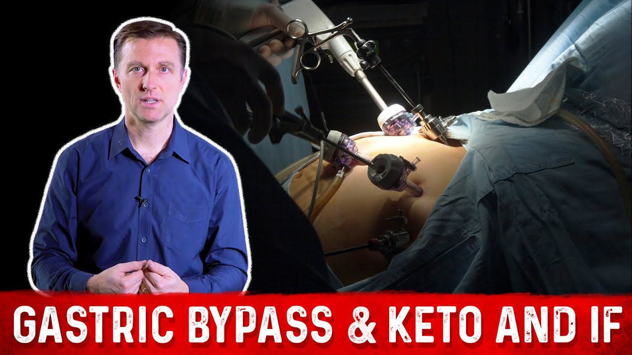 Gastric Bypass & Keto and Intermittent Fasting Dr. Berg YouTube