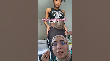 بعد الولادة تشهد العديد من النساء من ما يطلق عليه البطن الولادة 
