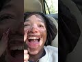 I’m ashamed 🤣🤣🤣 | #explore #vitiligo #funny #shorts