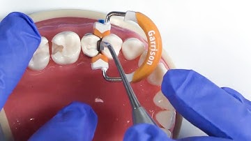 To Get the Best Adaptation and Less Flash, Do This...