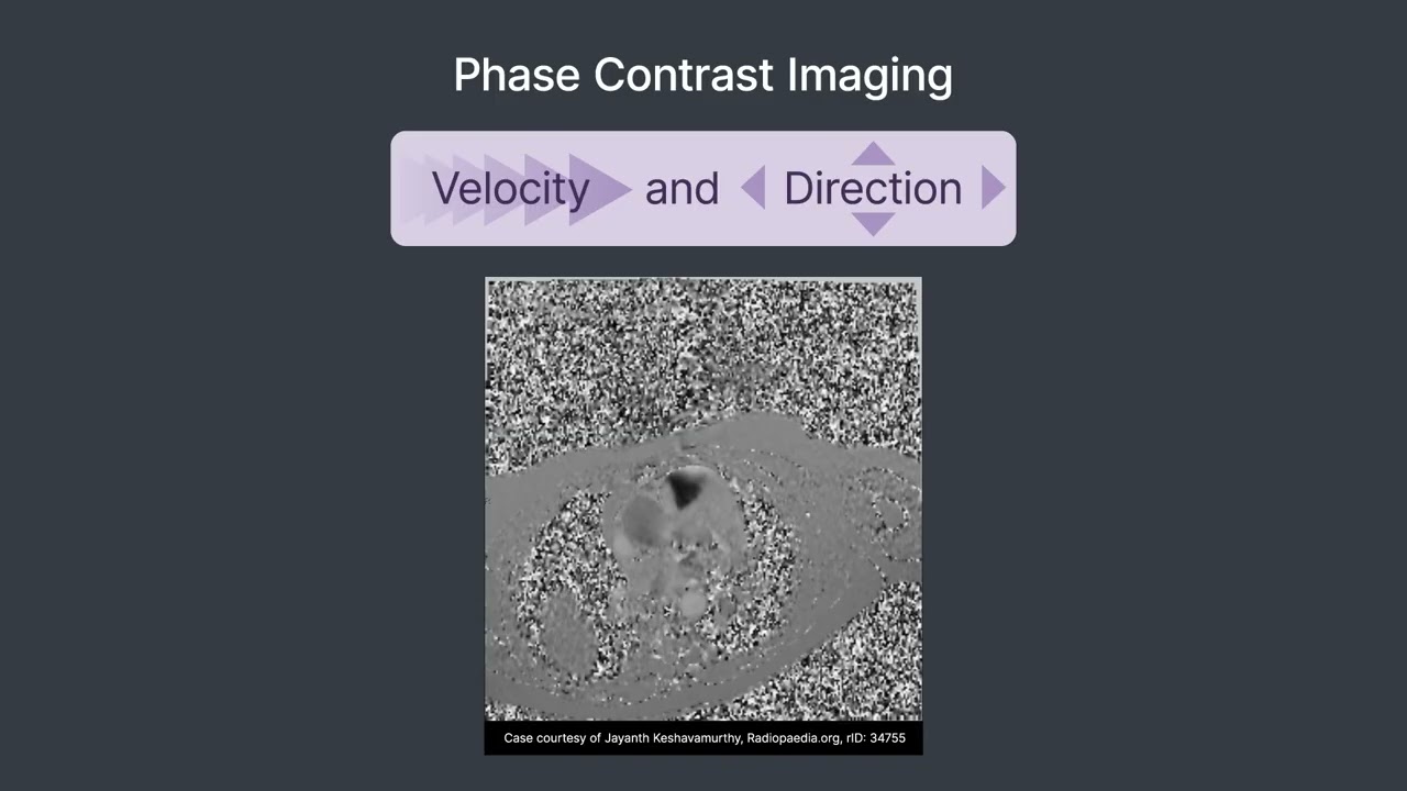 Cardiac MRI Made Easy: Protocols and Pulse Sequences