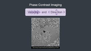 Cardiac MRI Made Easy: Protocols and Pulse Sequences