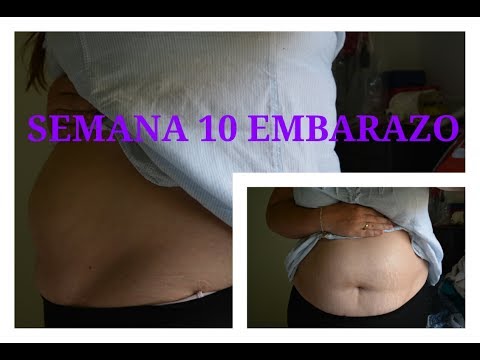 semana 10 embarazo semana 10 embarazo