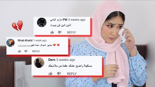 تعليقات التنمر اللي جاتني بسبب خشمي.. Q&amp;A