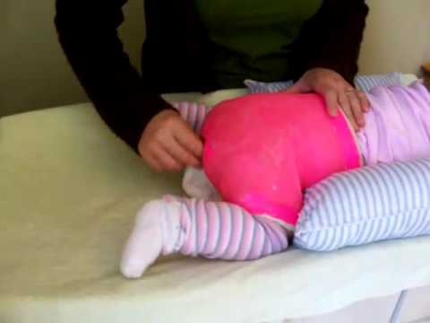 How to change a diaper in a SPICA cast.Super easy w/the hipstix order@ www.greatgirldesigns.etsy