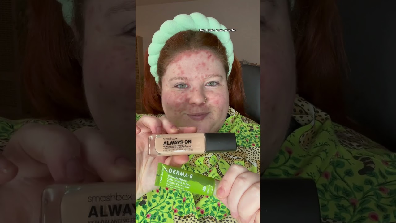 Psoriasis Makeup // How I Cover my Face Psoriasis