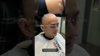 Bagaimana toupee berbeda dari wig biasa?