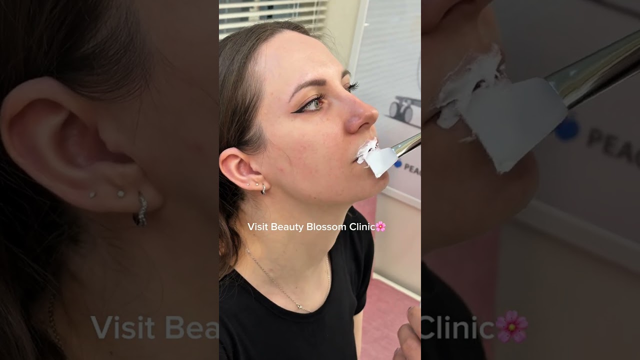 [Бьюти Блоссом Клиник] Гадаад хүмүүсийг ч татсан К-уруулын филлер! Өмнө ба хойнохыг дэлгэлээ✨