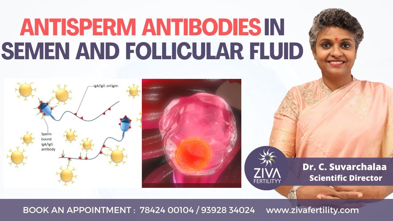 Antisperm Antibodies In Semen And Follicular Fluid IVF Dr C