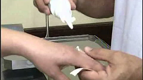 O que fazer para tirar aliança do dedo inchado?