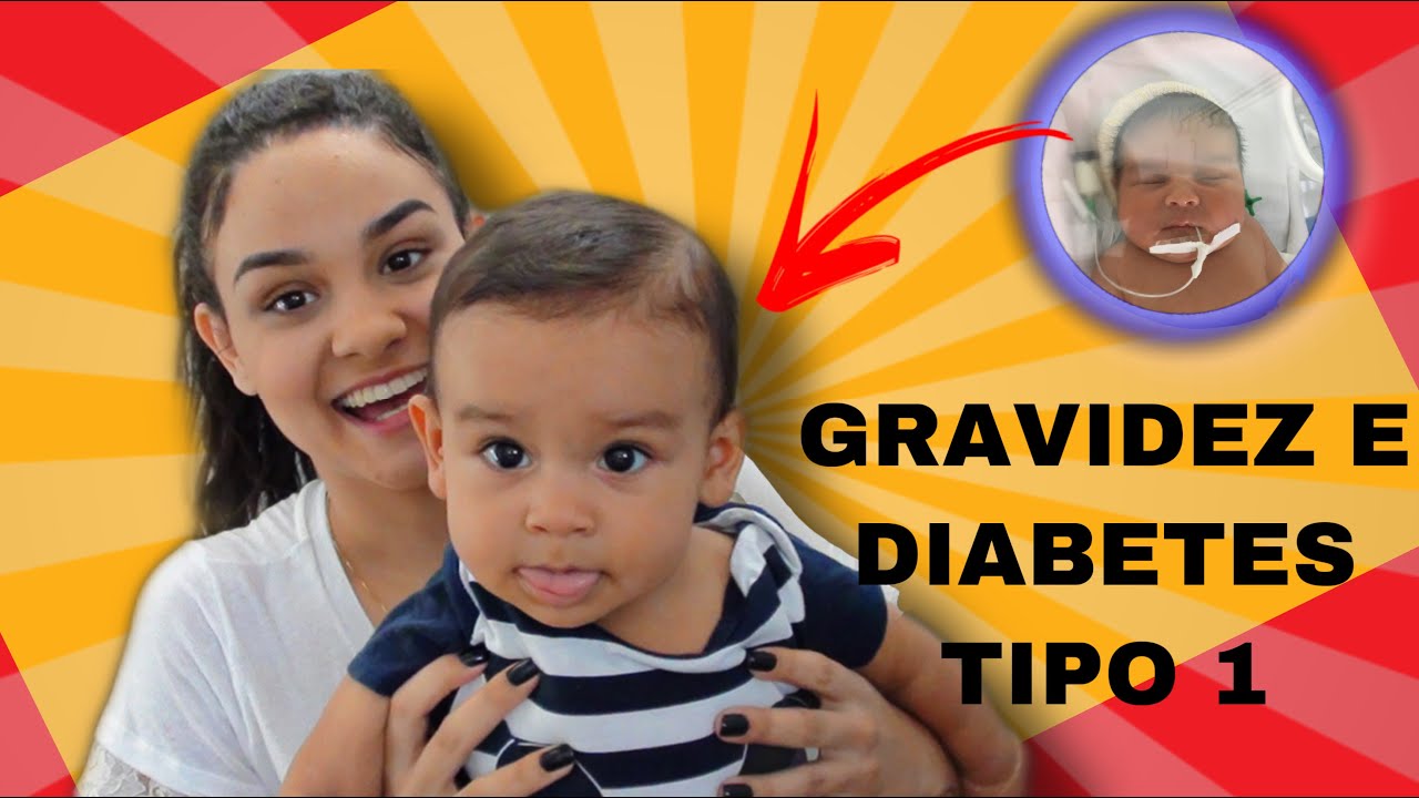 O Que é Um Bebê Gig - BRAINCP
