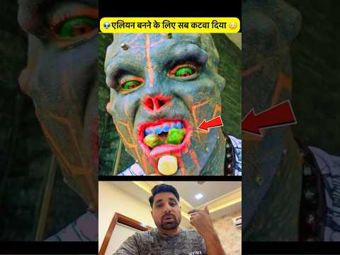 एलियन बनने के लिए सब कुछ कटवा दिया