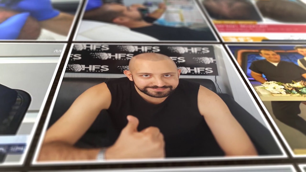 TÜRKİYENİN EN ÇOK SAÇ SİMÜLASYONU YAPAN FİRMASI - YouTube