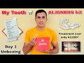 My Invisible Aligner || Unboxing of Aligner | Invisible Cost 43,000₹ in India | Toothsi teeth Result