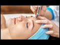 Skin Polishing (Microdermabrasion) - Treatment Procedure for Glowing & Smooth Skin | La Midas