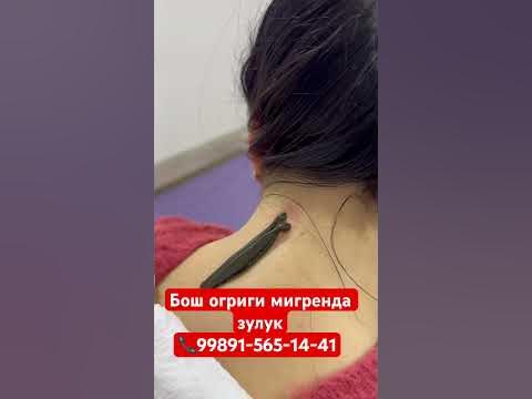 Зулук пявка хижома 📞99891-565-14-41 #reels #respect #жиззах - YouTube
