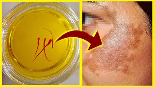 Apply 1 Drop of MAGIC Yellow Oil, Remove SUN SPOTS - Wrinkles😮!Anti-Aging Saffron Oil
