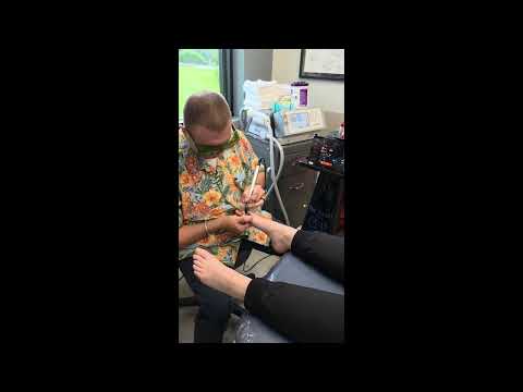 NailBlaster™ Treatment in Wichita, KS