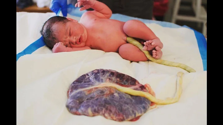 Arizona parents keep placenta attached to baby after birth - DayDayNews