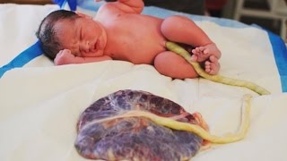 Arizona parents keep placenta attached to baby after birth