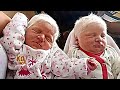 She gave birth to twin albinos with white hair… Here is what they look like now !!