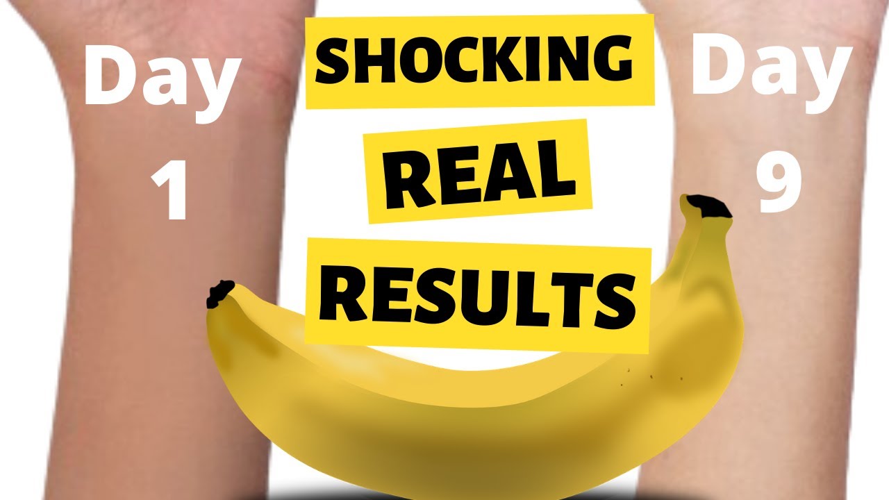 Banana for SKIN Whitening , Face Mask and Banana for SKIN and Face Benefits YouTube