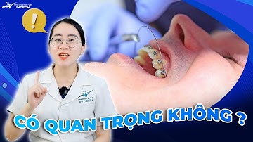 Dây Cung Niềng Răng: 4 Giai Đoạn "Bắt Buộc" Thay Dây Cung Niềng Răng (100% Niềng Răng Sẽ Trải Qua)