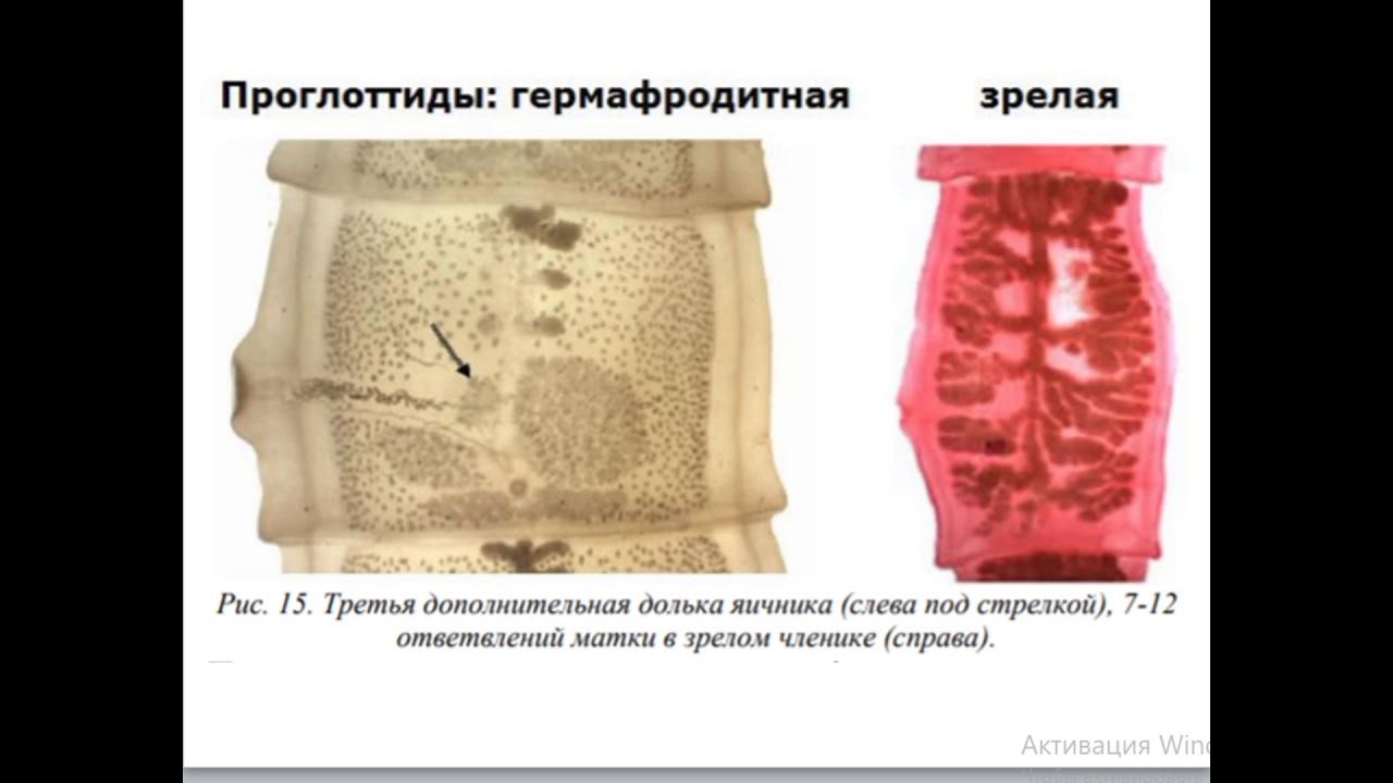 Бычий цепень дегенерация