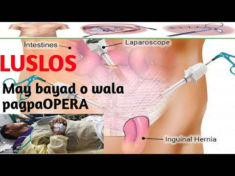 Luslos /Hernia surgery