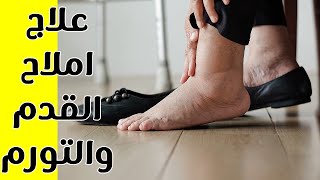 علاج الاملاح في القدم || علاج الاملاح وتورم القدمين والانتفاخ والتخلص من ترسبات الاملاح في الكلى