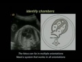 Efficient and Effective Interpretation of the Four Chamber Heart View and Views of the Great Arterie