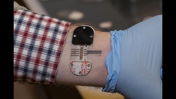 Sweat sensors: Engineering breakthrough tools for health diagnostics - Science Nation