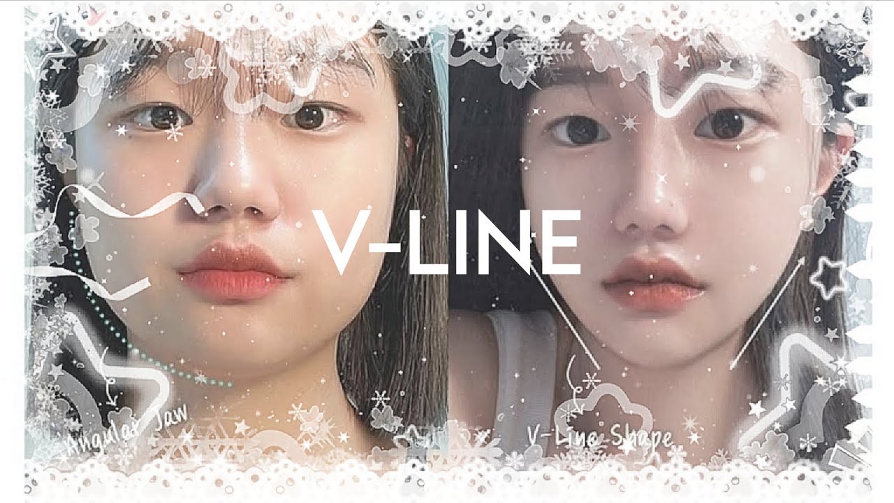𝐕-𝐒𝐇𝐀𝐏𝐄𝐃 𝐅𝐀𝐂𝐄 ✦ extreme jawline + narrow chin transformation - Subliminal 🥂🪐