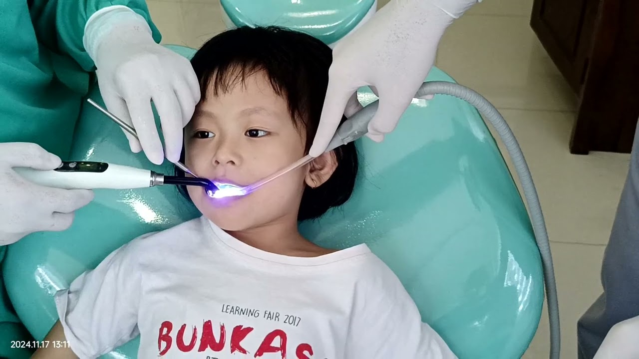 Mikhaila Tambal Gigi Kedua Kali dengan drg. Eric Sulistyo, Sp. Perio di Klinik Gigi 2000 Tiga