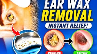 Blocked Ears Cleared Safely / Ear Wax Syringing & Suction Clearance.