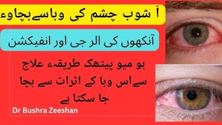 Increase the infection of conjunctivitis outbreak in Karachi ,, Treatment,Preventions