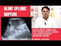 Blunt trauma of spleen | Splenic trauma | FAST ultrasound | abdominal ultrasound | Spleen ultrasound