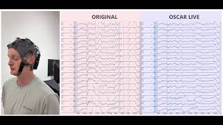 OSCAR LIVE with g.Nautilus PRO Flexible | Real-Time EEG Artifact Correction During Extreme Movement