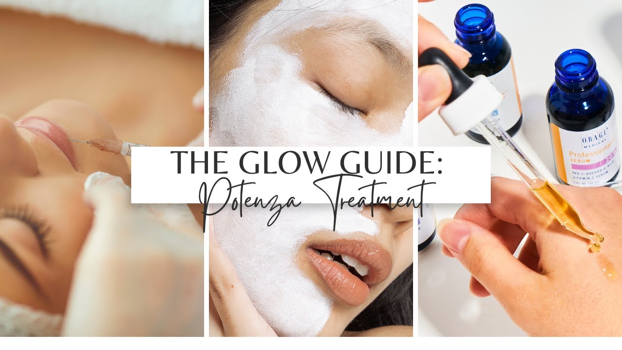 The Glow Guide: A Potenza Treatment