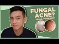 SMALL BUMPS ON THE FACE: Fungal Acne Ba Talaga? | Jan Angelo