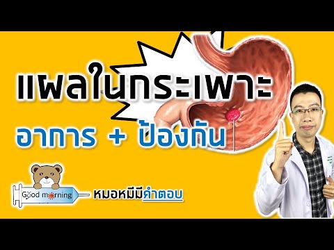 อาการและวิธีป้องกันแผลในกระเพาะอาหาร | หมอหมีมีคำตอบ