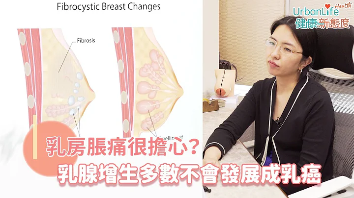 【乳癌症狀】乳房脹痛很擔心？醫生：乳腺增生多數不會發展成乳癌｜UL女性健康｜UrbanLife Health 健康新態度 - 天天要聞