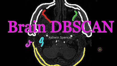🧠 Revolutionary DBSCAN Brain MRI Segmentation: See Algorithms Think Like Neurologists! 🧠