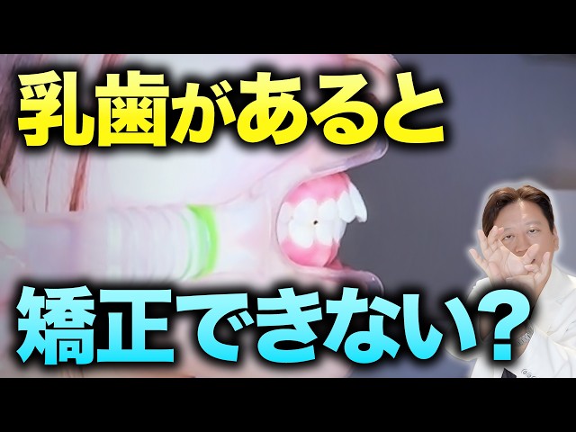 Can Baby Teeth Be Orthodontically Corrected? How to Straighten