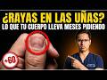 Si tienes estas LÍNEAS en las UÑAS, a tu cuerpo le falta ESTO (No es la edad)