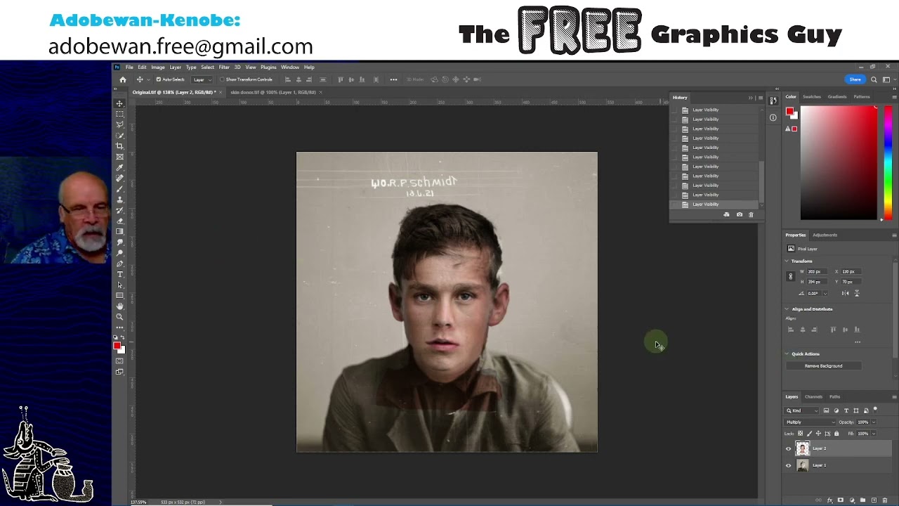 colourisation with skin donor