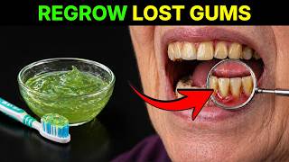 7 Gum Regrowth Secrets Your Dentist Won’t Tell You