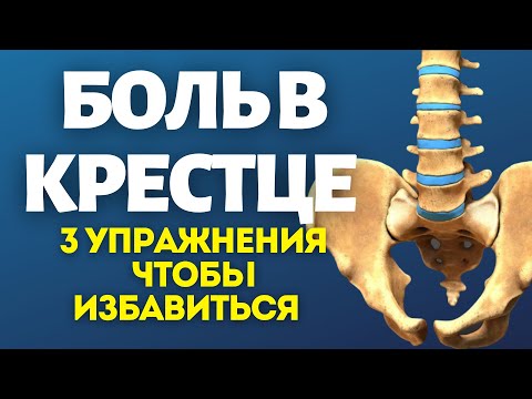 Боль в крестце. 3 упражненя чтобы избавиться.