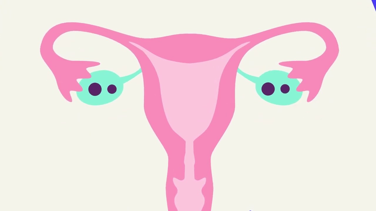 Метод контрацепции с использованием вагинального кольца: как он предотвращает беременность?